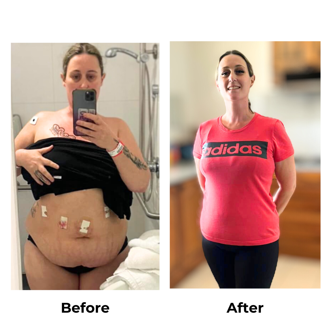 Beck lost 22 kg after gastric sleeve surgery